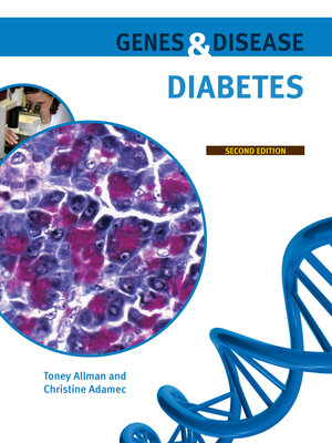 cover image of Diabetes